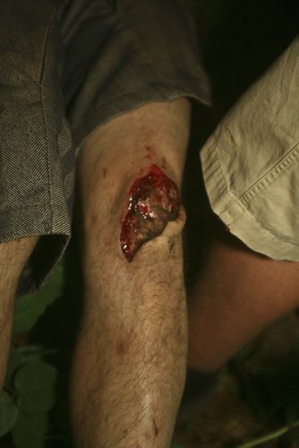 Kona Trevor's nasty little walking incident, GET WELL SOON DUDE!