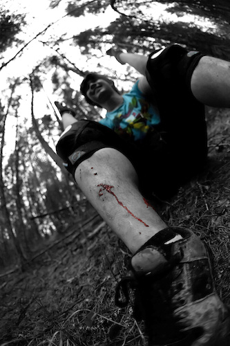 Pedals to the shin, we all know how that feels. Photo by Katie Hayes