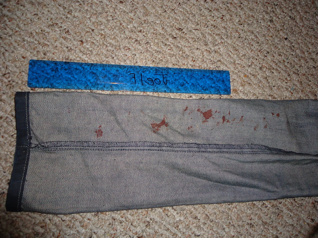 These are my pants after I messed up my shins...
