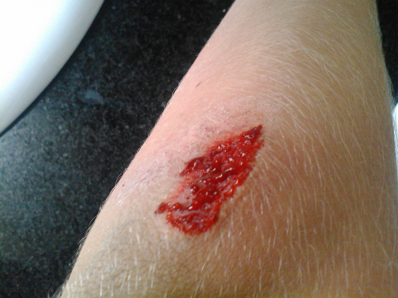 Just messed up myself on the fuckn Rockfield!!