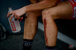 This is a part of the life of a mountain biker. Blood is common, but giving up is not.