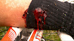 Gore, compound fracture. Round 1 of the Australian National Series 10/11.