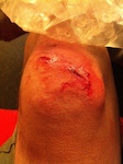 bad knee :)