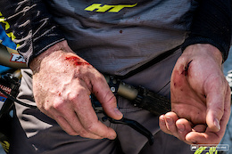 Pinkbike Poll: Do You Ride With or Without Gloves?