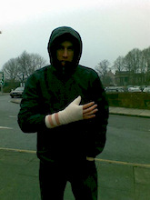 Gee damages thumb!