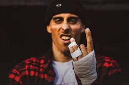 Amaury Pierron Broke Metacarpal in Practice Crash – Mont-Sainte-Anne World Cup DH 2024