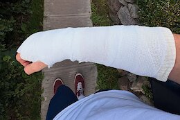 Hattie Harnden Shares Injury Update After La Thuile DH World Cup Crash