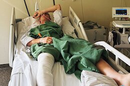 Emil Johansson Shares Injury Recovery Update After his 2025 Red Bull Rampage Crash