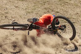 Injuries Suck, But They’re Part of Mountain Biking