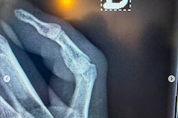 Myriam Nicole Sidelined for Andorra DH World Cup F