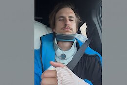 Reece Wallace Breaks Neck &amp; Hand While Filming