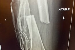 'Almost Every Step Is Painful' - Kurt Sorge Opens 