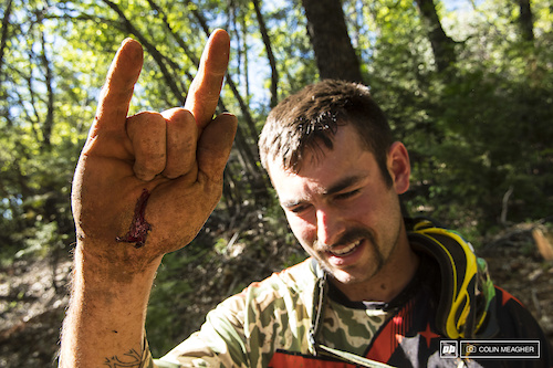 Hurts so good--Bobbie carcassed hard on the brief "Vigilante Trail" practice near the day's end and put a fun tattoo into his palm. He'd race stages 1 thru 5, but ultimately he'd DNF. Next year, Bobbie, next year.