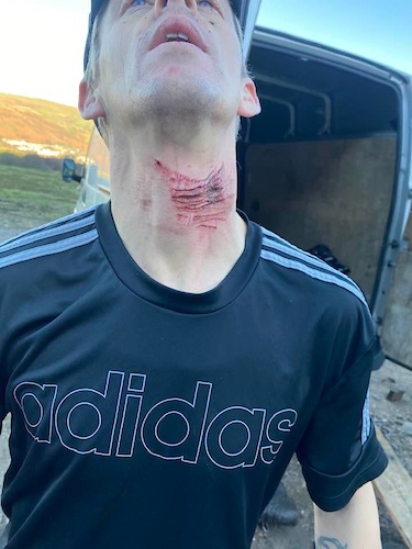 British Rider Needed 17 Stitches After Hitting Barbed Wire Trail
