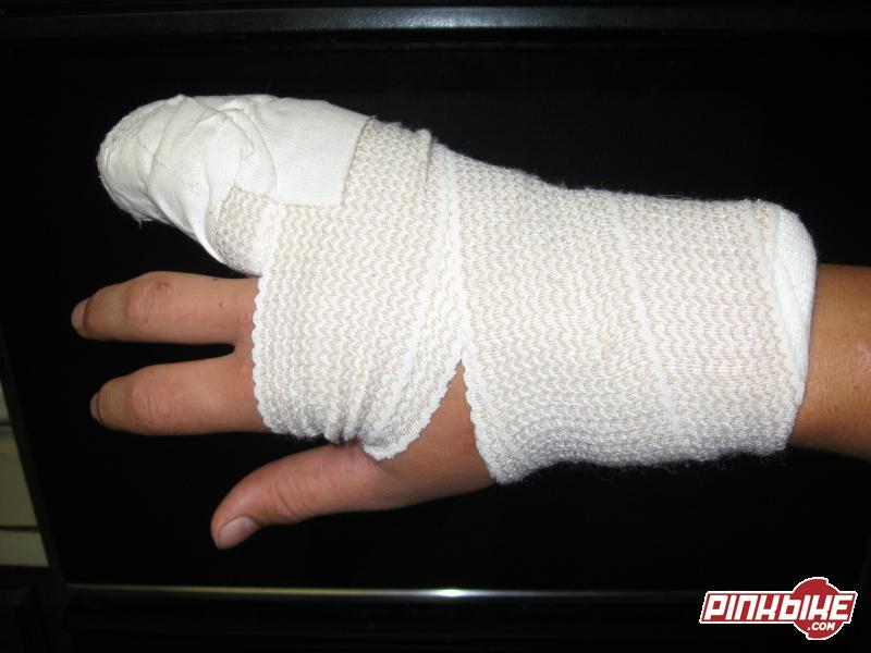 My broken hand that realy shouldnt be broken. Dr. says it will be healed in 3 weeks....ill be back in the saddle in 1!:P