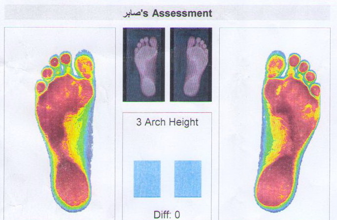 Foot 2D Scan