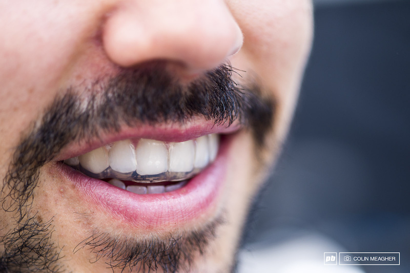 Marcello Gutierrez modeling his brand new mouth guard. I never thought about wearing one until I broke out a couple teeth. Now I always wear one. It has some other benefits too. When asked Gutierrez claims it aids his breathing and also works in the event of a crash to prevent concussions.