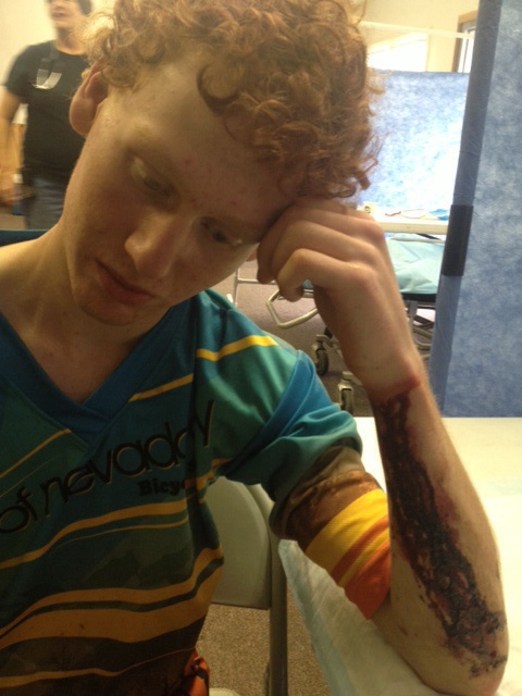 A hard crash towards the end of the race made a good run into one of the worst races of my season. 12 stitches needed!