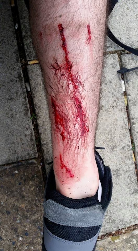 DMR Pedals are brutal. anyone recommend some shin/calf guards?