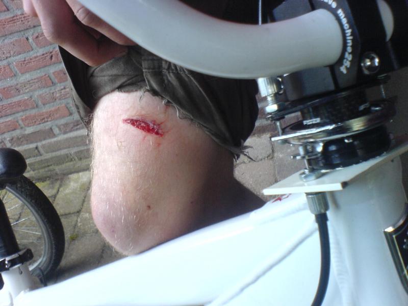 chain snapped, and my knee bashed into the (sharp)roto system baseplate(the white one under the headset.