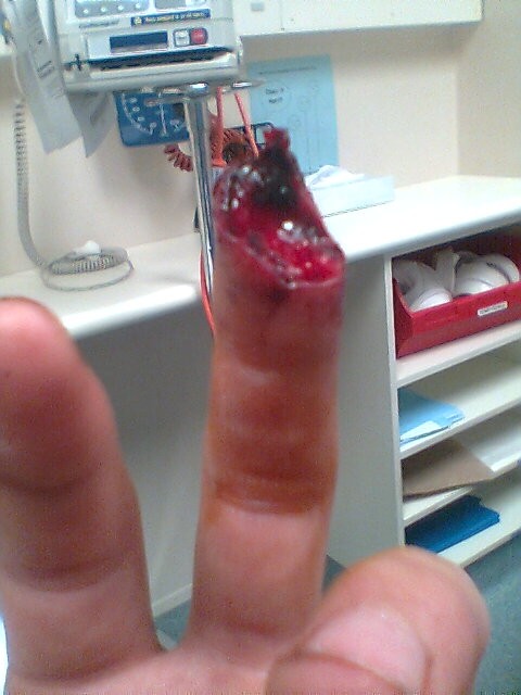 this is what happens when you put your finger in a front disk