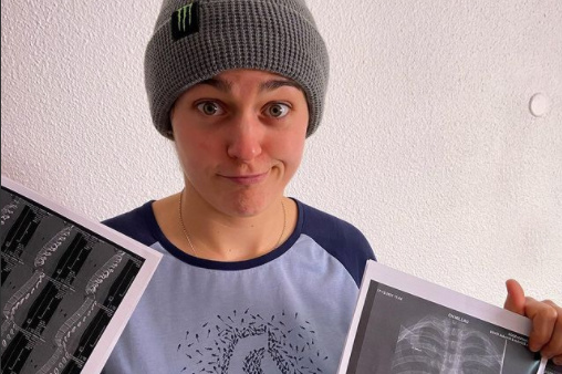 Marine Cabirou Reveals Broken Vertabrae - Pinkbike