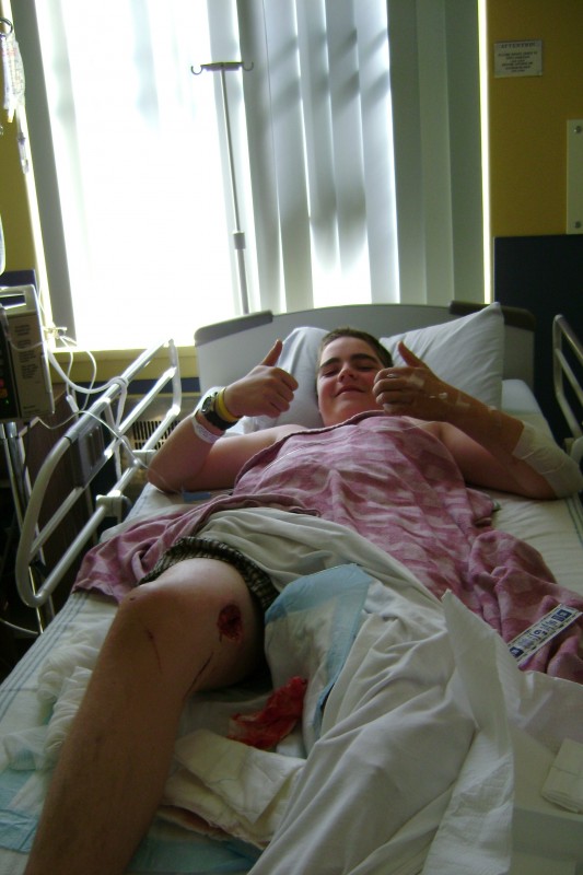 me with the massive hole in my leg (I'm huge-6feet tall and 180 pounds)