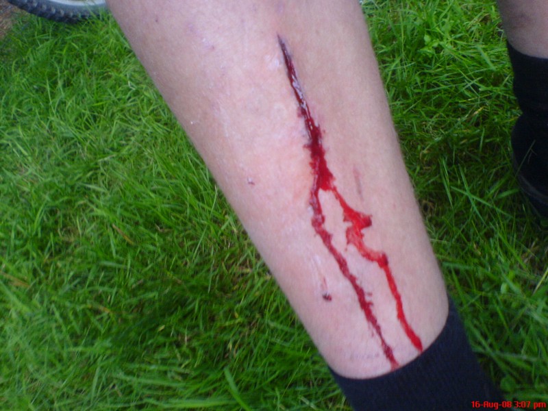 My shin after it had a disagreement with my pedal:D