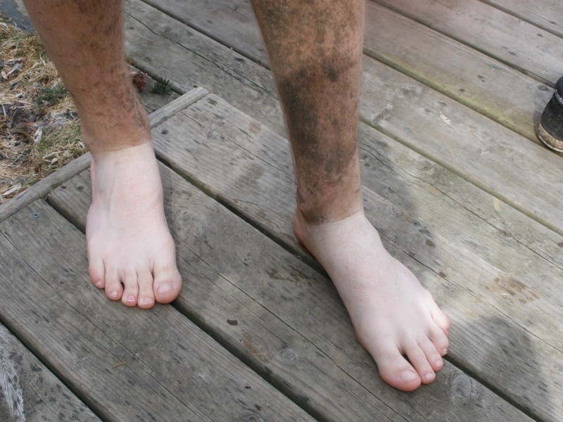brads dirty ass feet after a day of riding