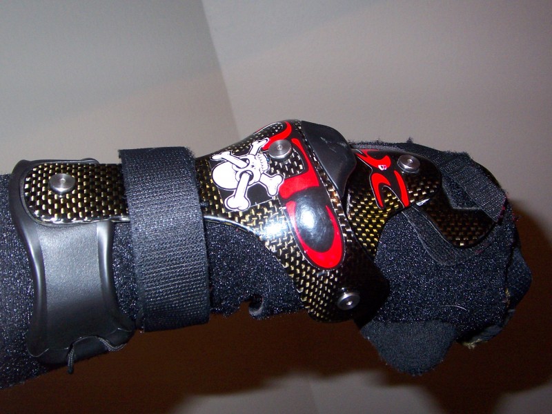 For any rider that has broke his or her wrist I would get the OTS CTI wrist brace.