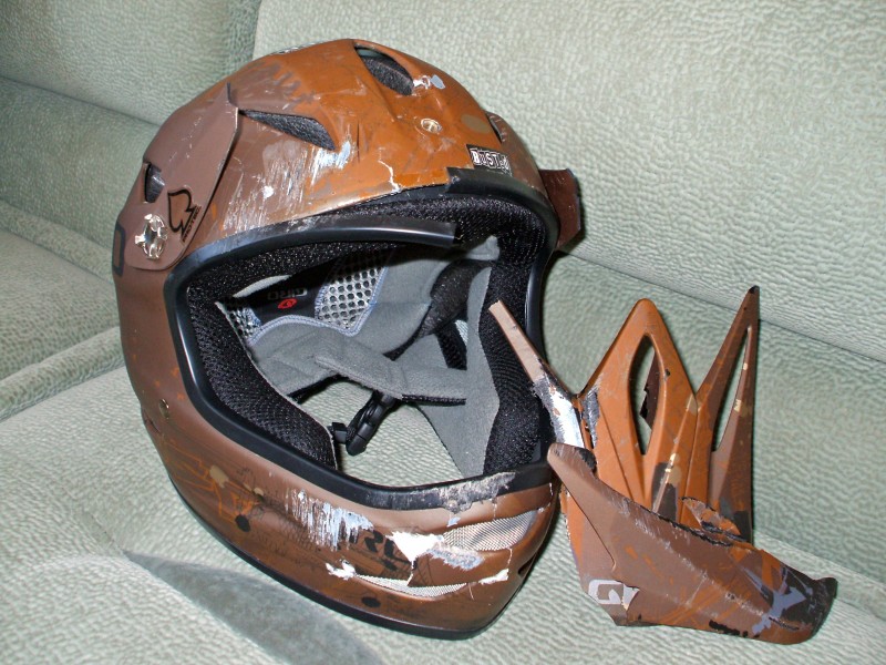 My Giro Remedy 2008 after a contact with the pavement. Really bad injuries. Can't remember the riding day. Abraded  jaw. Couple more scratches. All of the safety gear helped me. The helmet did its job.