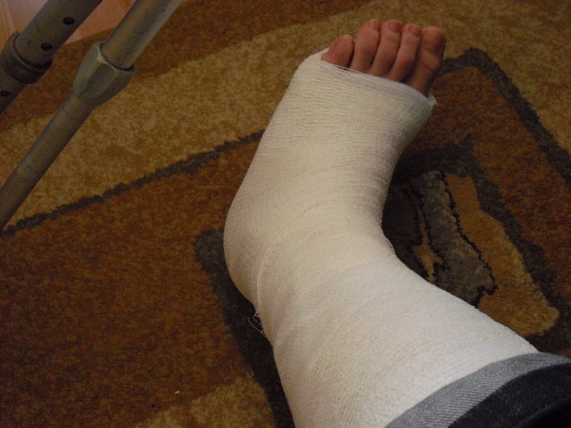 Craked ankle ; /...
And 2 weeks without Bike ...