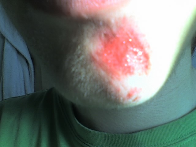 Just a scrape, not that bad.