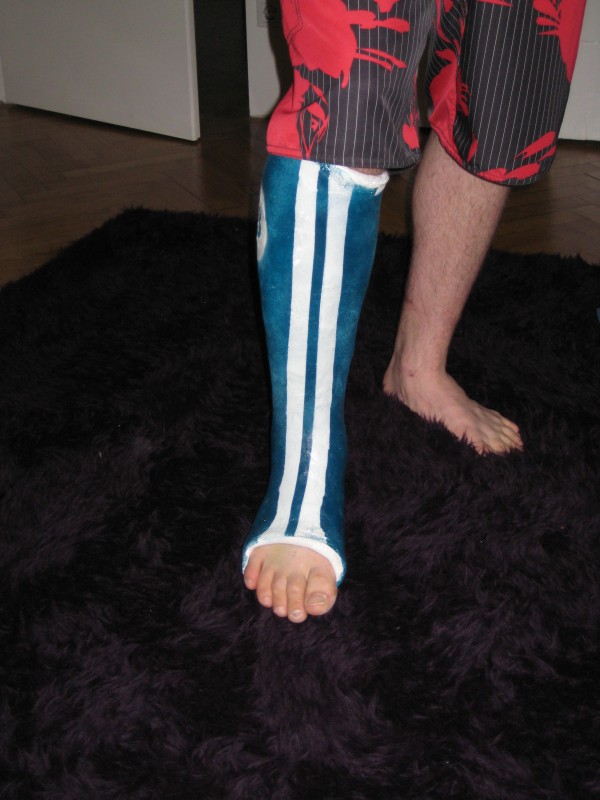 cast with racing stripes