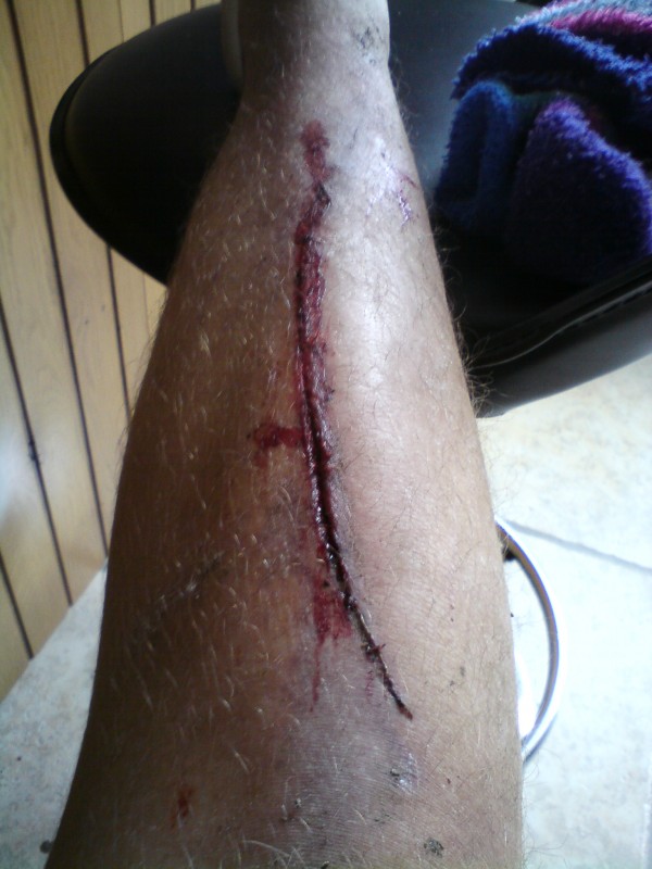 i scratched my leg