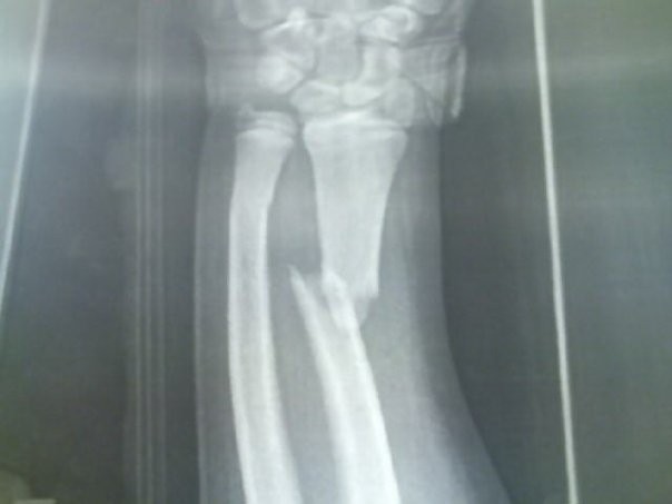 My X-Ray