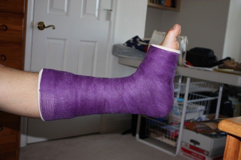 purple cast