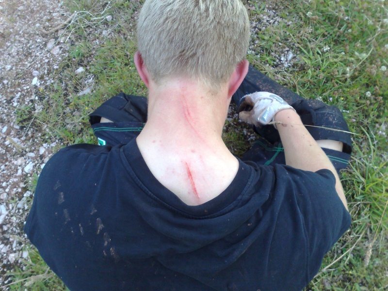 clipped a landing at a funny angle and got a pedal in my neck great times