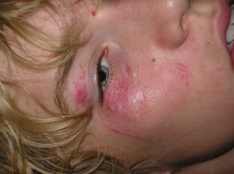 my face after crash in summer 09