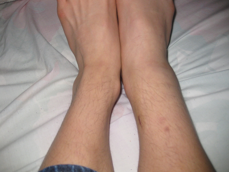 Ankle!!!!!! lesson learned: take off pegs before trying tailwhips.