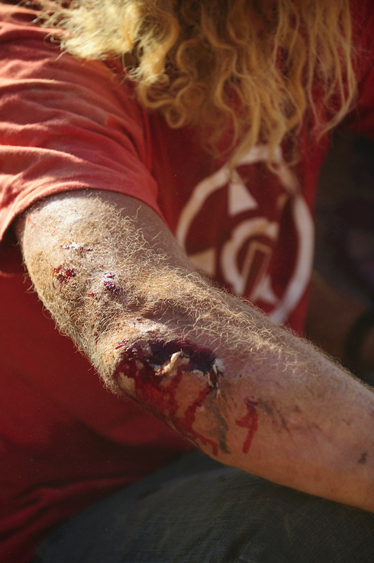 Luckily it was a mere flesh wound.