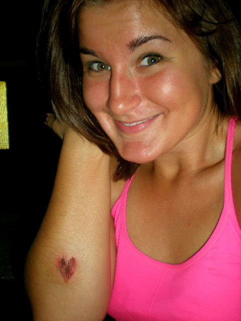 Scabs are way better when they are heart shaped!