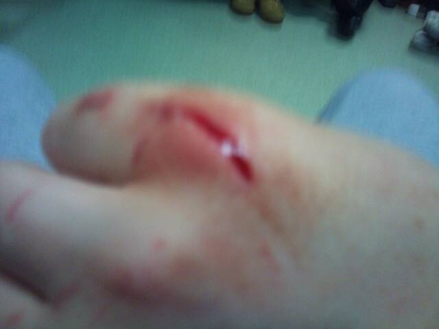 Punched a varse when i was abit mad! Lol deeper than it looks ;)