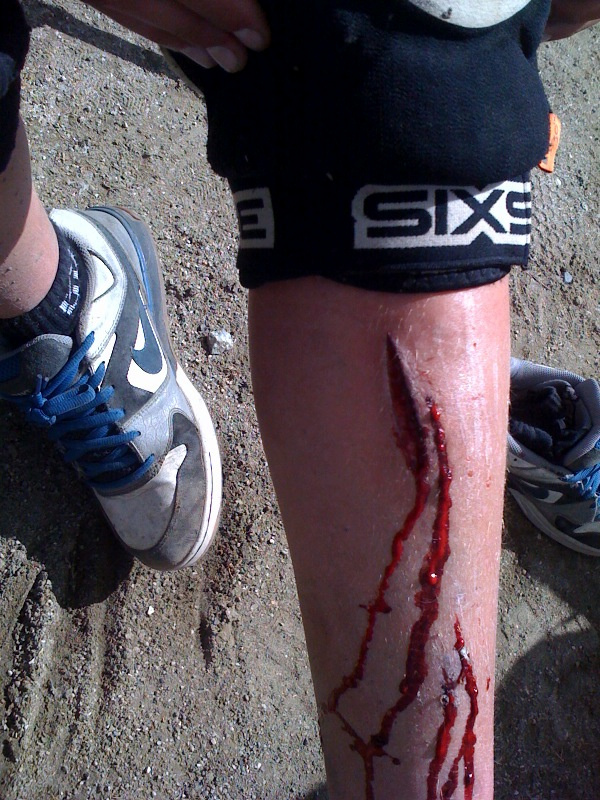 2010 Sea Otter DH, some nice gashes