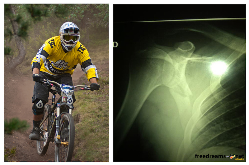 Javier Guerrero broke his shoulder blade in the qualifying heats