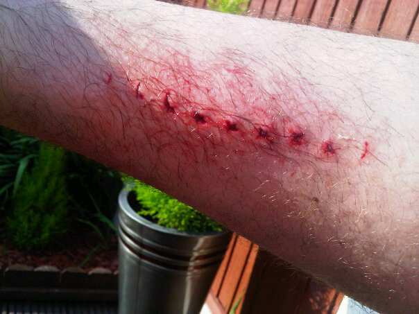I was doing about 15mph do a small drop chain bounces off, i set off peddling feel no resistance it spins right round foot hits the floor and....... Ouch :(