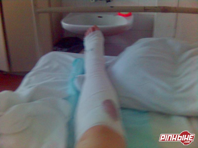 I broken leg... Wires in leg mum... 
I am after operation already  
 

