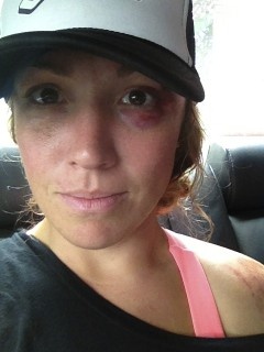 My black eye is courtesy of the helmet-smashing fall I took during practice the morning of the Windham ProGRT race... Didn't end up racing due to the fall (and the resulting shoulder dislocation and head banging), but I sure brought a nice souvenir home!