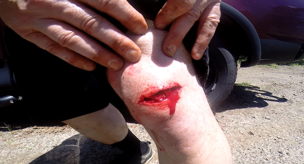 Sliced my knee open on a jagged rock...