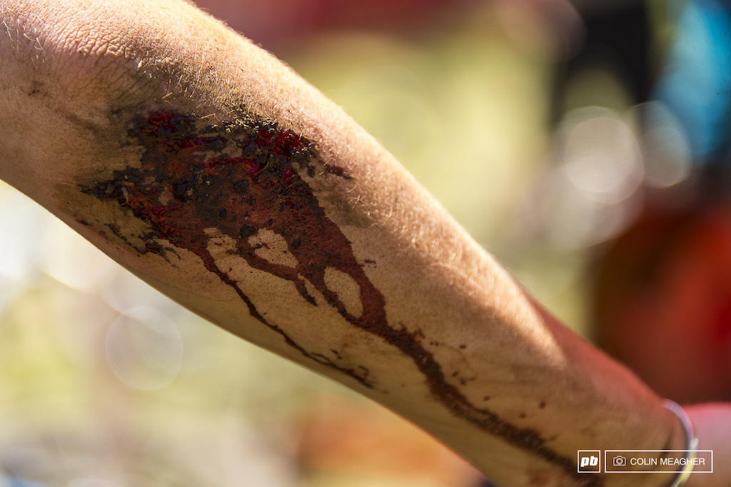 Pushing hard on the loose dirt of Post Canyon had consequences.